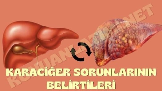 Karaciğer Sorunlarının Belirtileri